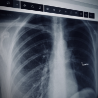 CXR reporting via