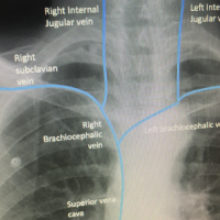 view of teaching material