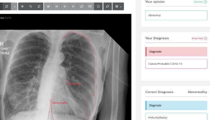 View of CXR case